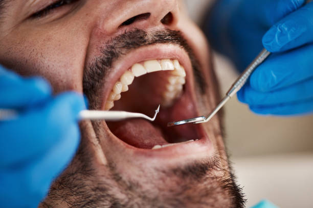 Best Emergency Treatment for Jaw Pain or Injury in Soquel, CA