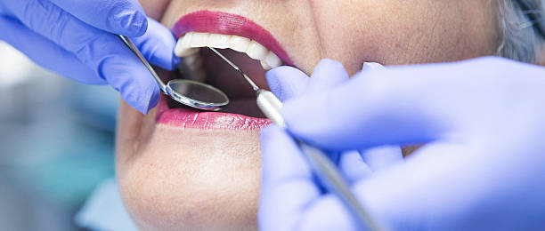 Best Dental Abscess Treatment in Soquel, CA
